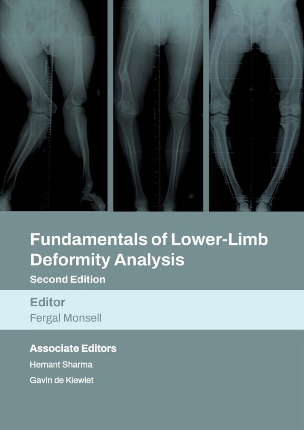 Fundamentals of Lower-Limb Deformity Analysis - Second Edition