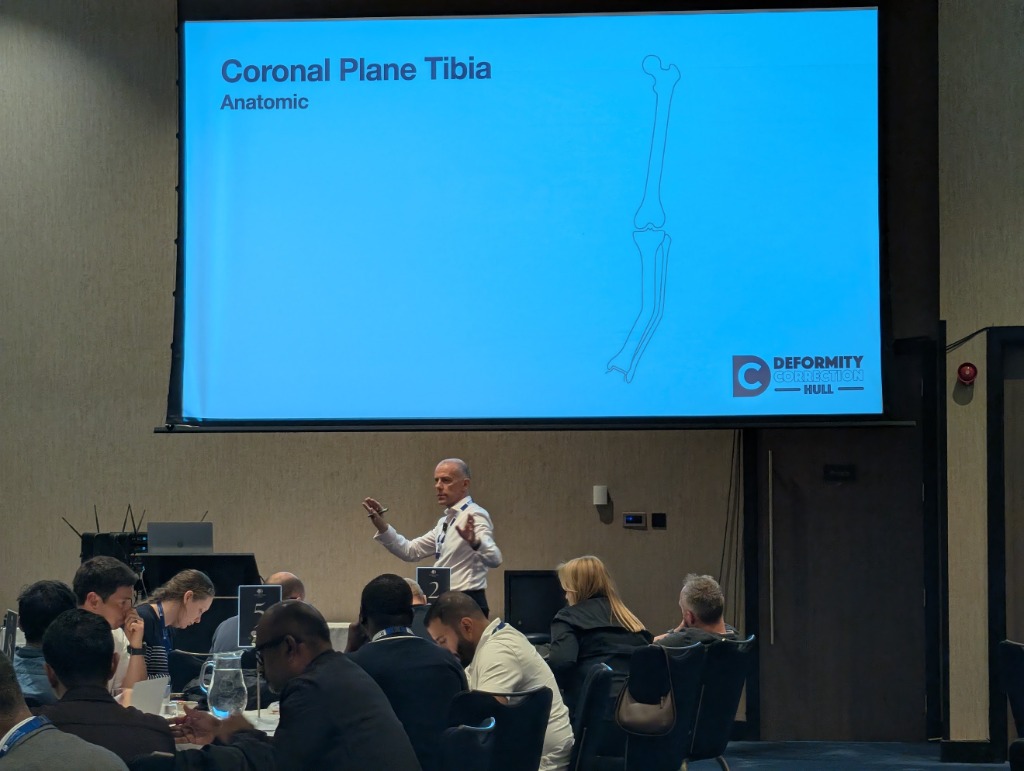 Coronal Plane Tibia Deformity Analysis Lecture